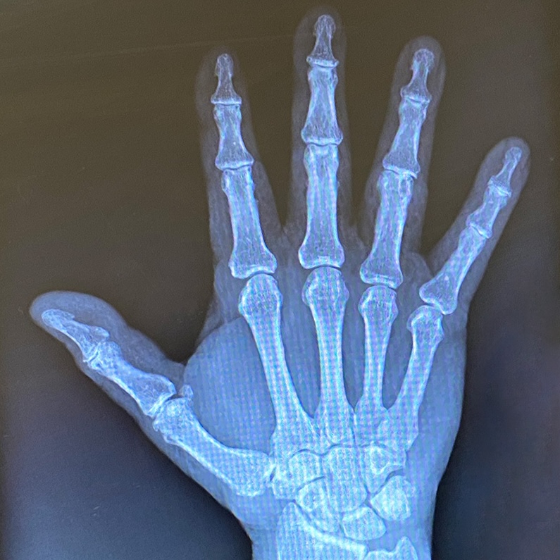 photo of High Five